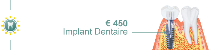Implant Dentaire