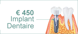 Implant Dentaire