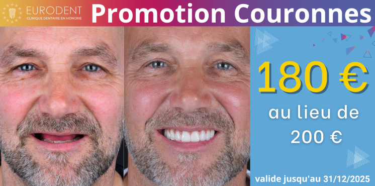 Couronne Dentaire Action